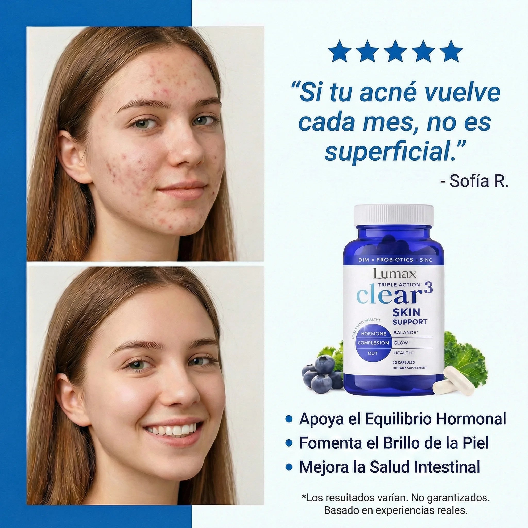 Skin Clear-3 | Reduce Brotes  y Controla el Acné Recurrente